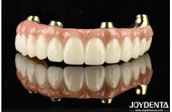 China Functionality Ti-Bar Compatible With Natural Teeth And Gums Restores Chewing Function supplier