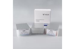 China Lab Use Pre Filled Nucleic Acid Extraction Purification Detection Kits supplier