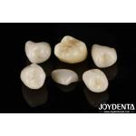 Easy Cementation Emax Inlay Onlay Medium Strength Natural-looking Esthetics for sale