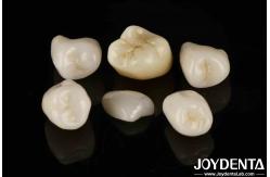 China Easy Cementation Emax Inlay Onlay Medium Strength Natural-looking Esthetics supplier