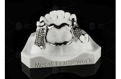 China Repairable Cobalt Chromium Dental Metal Framework Partial Denture supplier