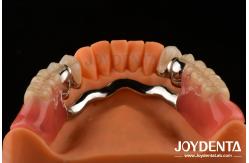 China Framework Setup Teeth Finish Elaborate Technology Beautiful Harmonious Appearance Design supplier
