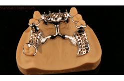 China Upper Cast Framework Acrylic Metal Partial Dentures Strong Lightweight and Durable supplier