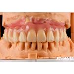 Comfortable Wear Acrylic Denture Finished With Tooth Arrangement Technology for sale