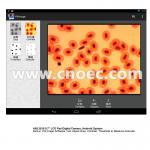 9.7inch LCD Pad Digital Camera , Android System Microscope Accessories A59.3510