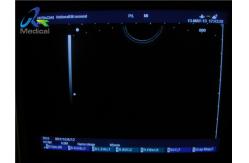 China Hitachi EUP-V53W Endocavity 10mm Ultrasound Transducer Probe supplier