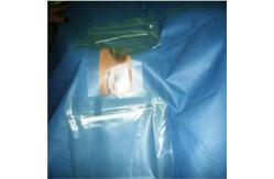 China Ophthalmology Multiple Layer Sterile Surgical Drapes With Pouch supplier