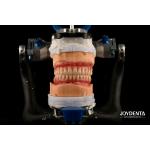 Lightweight Comfortable Fit Acrylic Dental Denture Finish Professional Personalization for sale