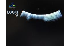 China Efficient Ultrasound Probe Overhaul Maintenance And Repair Service supplier