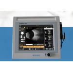 Mini 60V Ultrasound Scanner Machine AB Diagnostic Instrument Measure Eye Axis Length