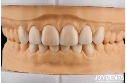 China Lightweight Property Flexible Denture Finish Personalized Customization For Diverse Specifications supplier