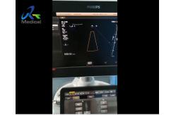 China PRB Board Ultrasound Machine Repair Philips EPIQ 7C Switch Probe No Echo supplier