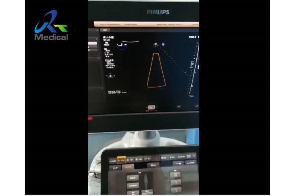 PRB Board Ultrasound Machine Repair Philips EPIQ 7C Switch Probe No Echo