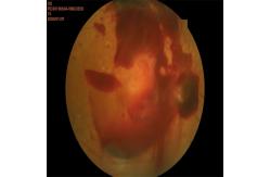 China High Resolution Automated Fundus Camera with FFA or FAF, mosaic function supplier