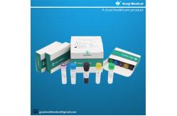 China Monkeypox Virus MPV Nucleic Acid Detection Kit Real Time PCR Method supplier