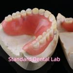 High Esthetic Acrylic Partial Denture Dental Resin Dentures With Base for sale