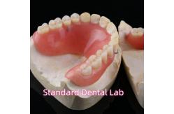 China High Esthetic Acrylic Partial Denture Dental Resin Dentures With Base supplier