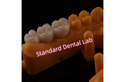 China High Translucent PFZ Layered Zirconia Bridge Porcelain Ceramic Posterior supplier
