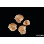 Customizable Shape Composite Inlays And Onlays Dental Stain Resistance Long Lasting for sale
