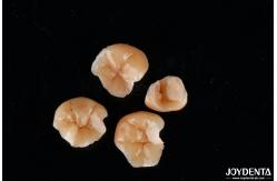 China Customizable Shape Composite Inlays And Onlays Dental Stain Resistance Long Lasting supplier