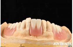 China Diverse And Lightweight Resin Material Acrylic Denture Finish supplier