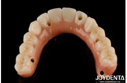China Natural Teeth And Gums Compatible Ti-Bar Zirconia Hybrid Bridge With High Biocompatibility supplier