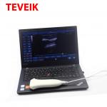 Medical Ultrasound Instruments USB Protbble Ultrasound Linear Probe