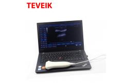 China Medical Ultrasound Instruments USB Protbble Ultrasound Linear Probe supplier