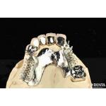Alloying Metal Dental Framework Removable Wearable For Dental Practitioners for sale