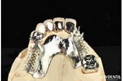 China Alloying Metal Dental Framework Removable Wearable For Dental Practitioners supplier