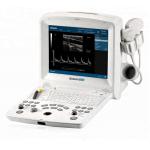 DUS 60 new compact ultrasound system for sale