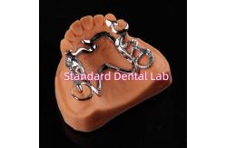 China Cobalt Chrome Framework Ni Be Free removable dental prosthesis China Dental Lab supplier