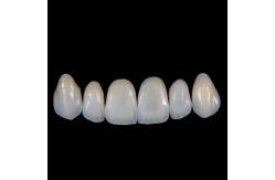 China High Translucency Emax Porcelain Veneers Crown with Better Materials by Ivoclar Vivadent supplier