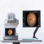 60Hz Automatic Fundu Dual Camera System Intellegent Operation for sale