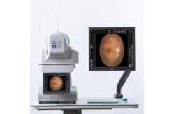 China 60Hz Automatic Fundu Dual Camera System Intellegent Operation supplier