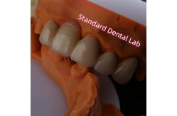 China Highly Biocompatible PFZ Porcelain Layered Zirconia With Pink Gum supplier